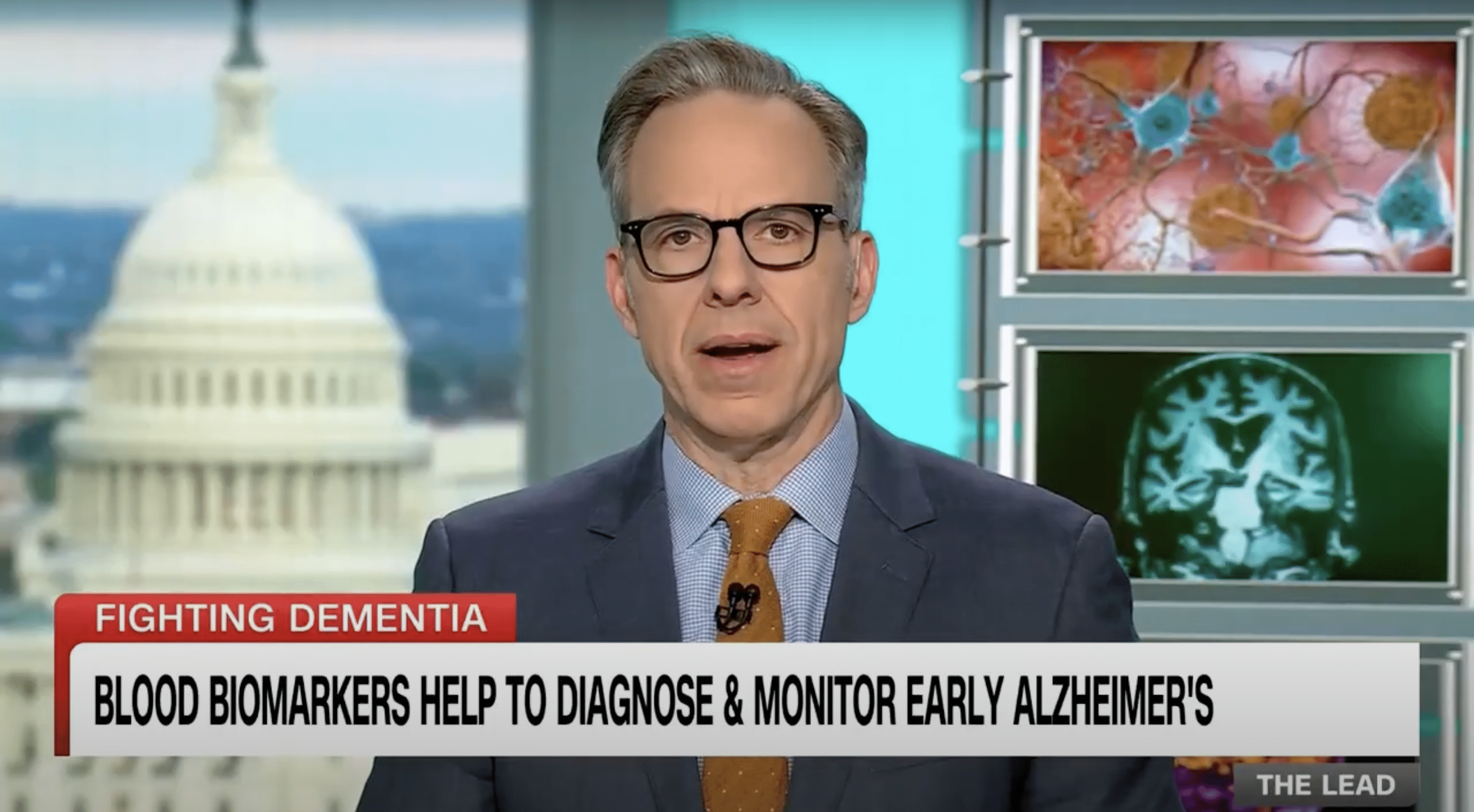 Blood Biomarkers Help Diagnose & Monitor Early Alzheimer’s